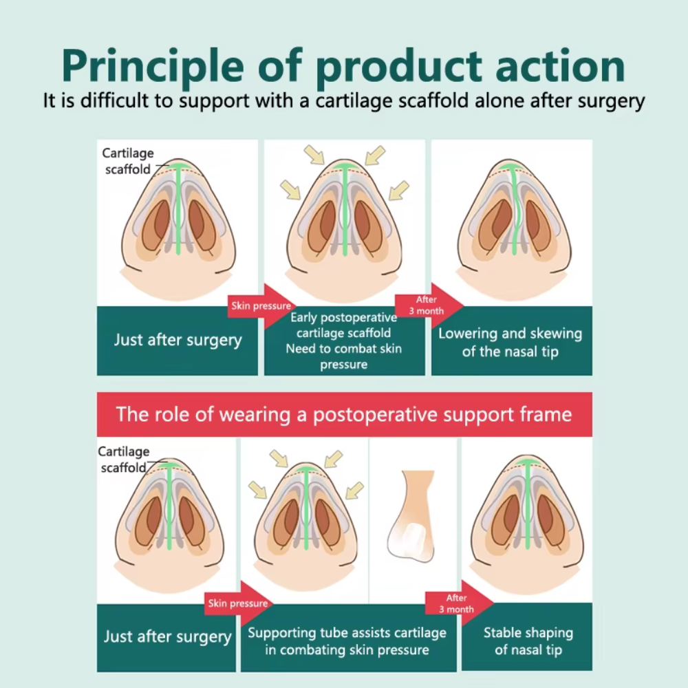 POSTOPERATIVE RHINOPLASTY NOSTRIL SUPPORT SILICONE DIAMETER 7mm-1
