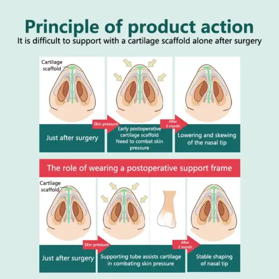 POSTOPERATIVE RHINOPLASTY NOSTRIL SUPPORT SILICONE DIAMETER 8mm photo 2